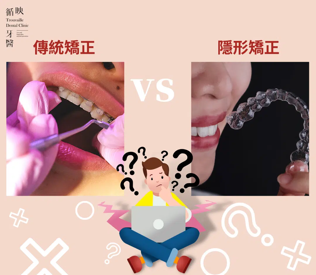 隱形矯正VS傳統矯正