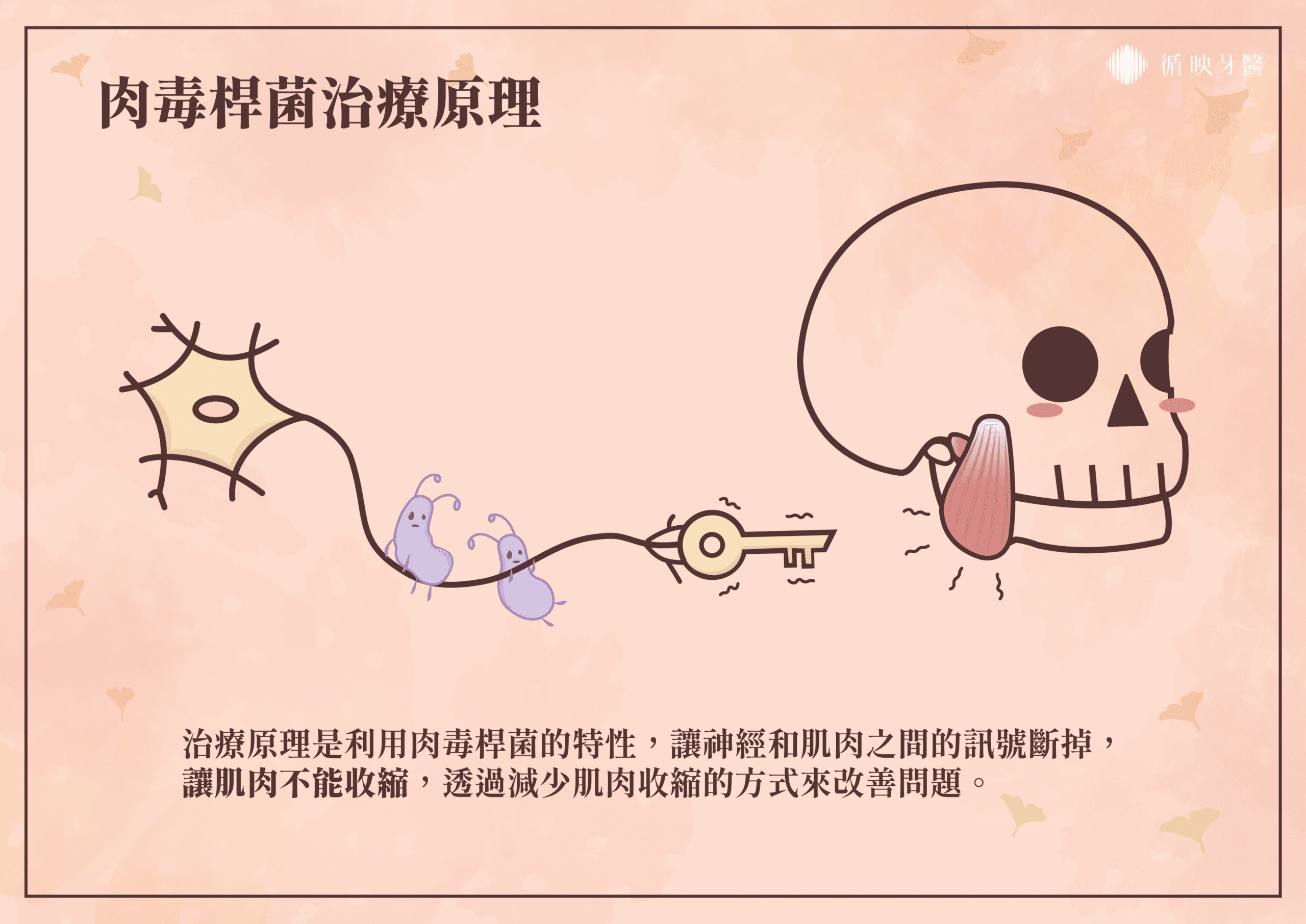 肉毒桿菌讓肌肉無法收縮！透過減少肌肉收縮的方式來改善問題。