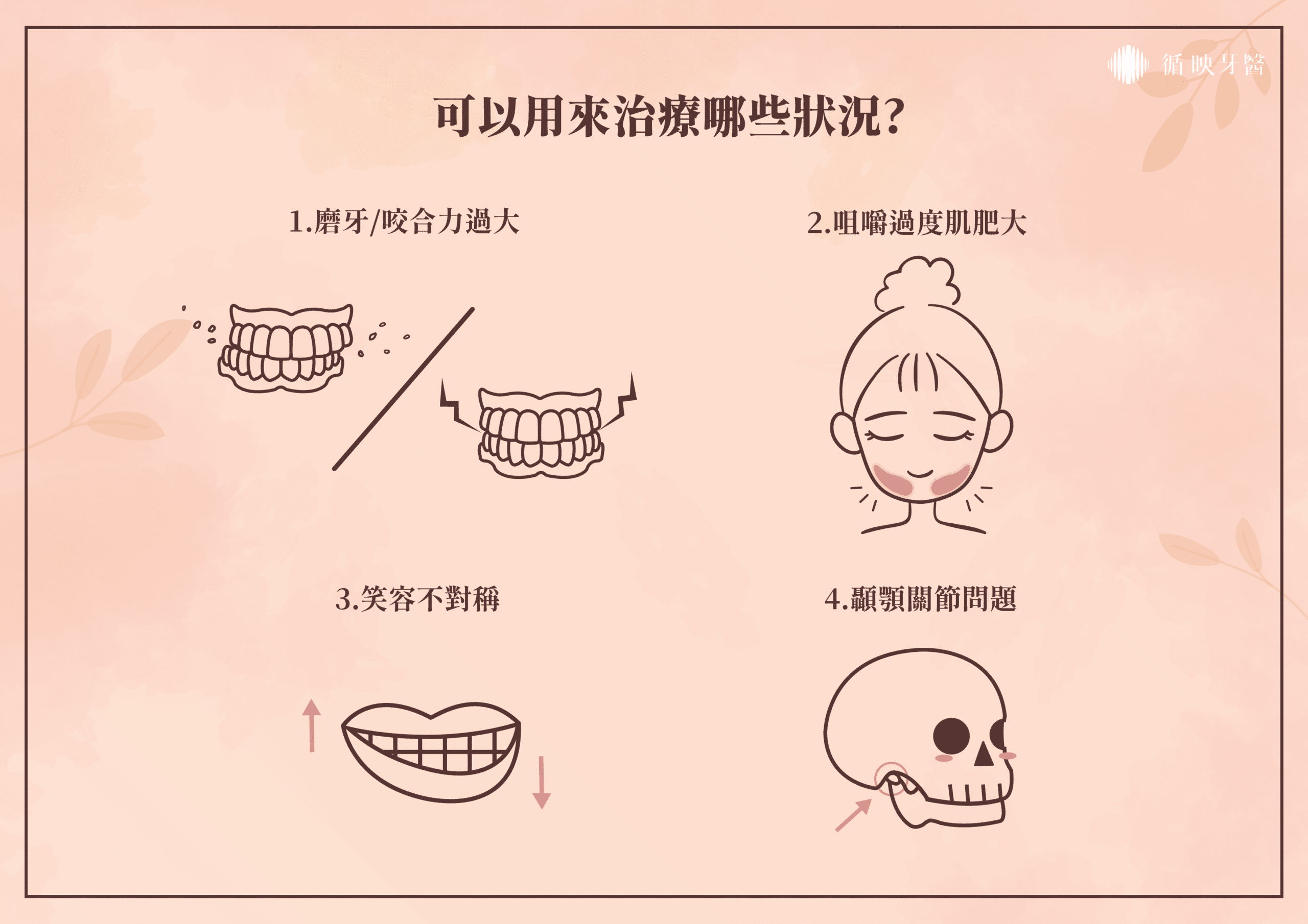 「放鬆咀嚼肌進而降低牙齒的傷害」才是牙科主要的目的。